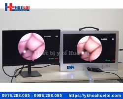 MÁY NỘI SOI TAI MŨI HỌNG FULL HD NCM-24