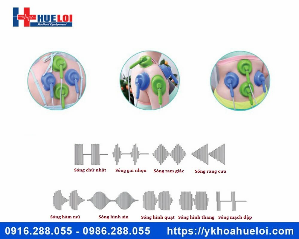 Máy điện xung kết hợp điện phân CSIIA