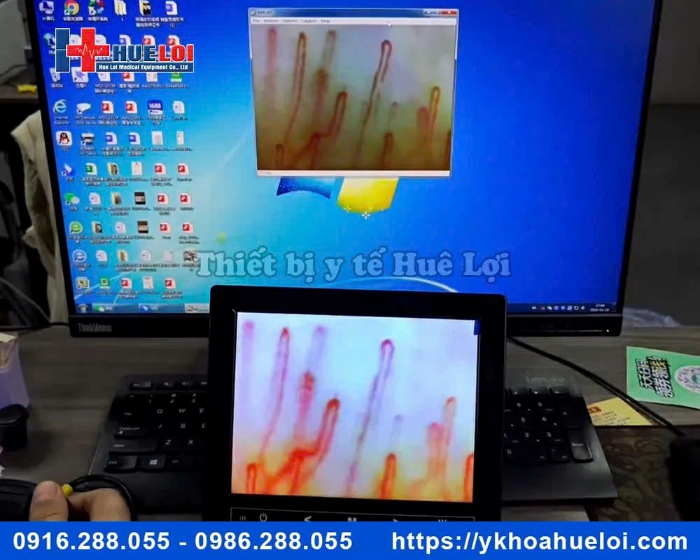 Kính hiển vi soi mạch máu cao cấp DN-880