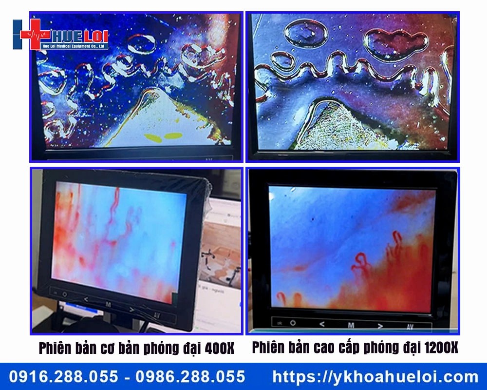 Kính hiển vi soi mạch máu cao cấp DN-880