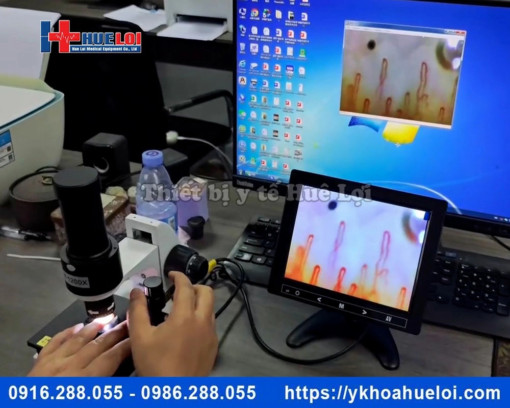 Kính hiển vi soi mạch máu cao cấp DN-880