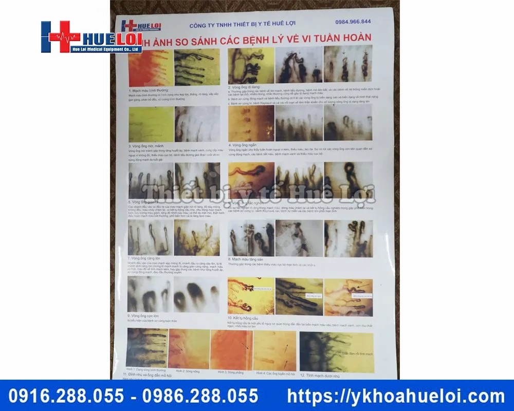 Kính hiển vi soi mạch máu cao cấp DN-880