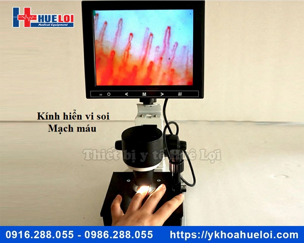Kính hiển vi soi mạch máu