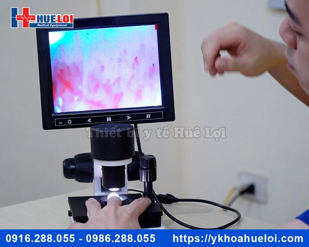 Kính hiển vi soi mạch máu