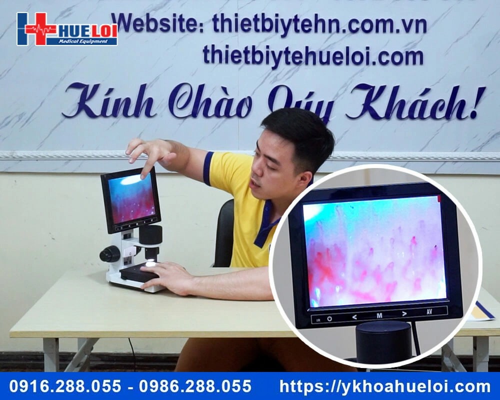 Kính hiển vi soi mạch máu