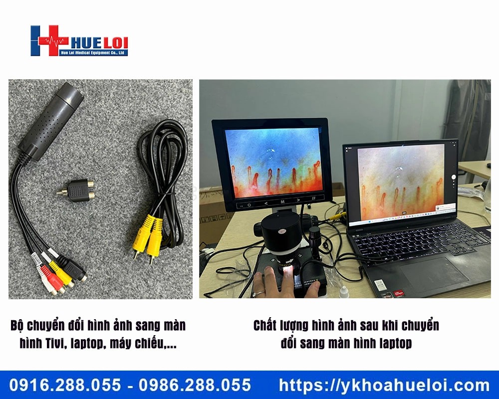 Kính hiển vi soi mạch máu