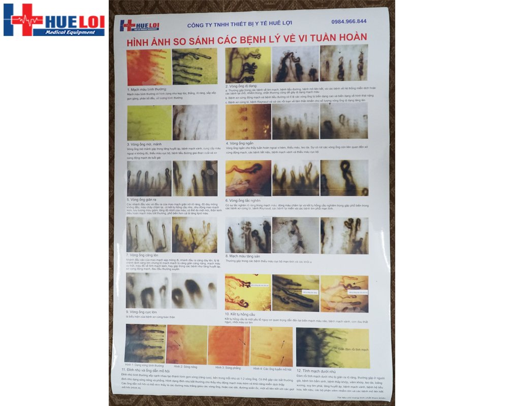 Kính hiển vi soi mạch máu