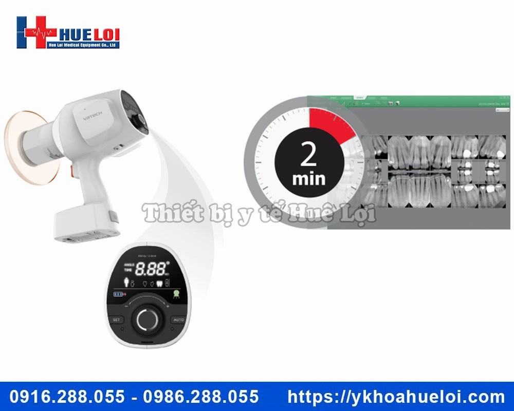 Máy chụp X-quang nha khoa di động