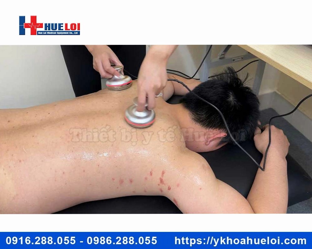 Máy điện châm không kim kết hợp giác hút