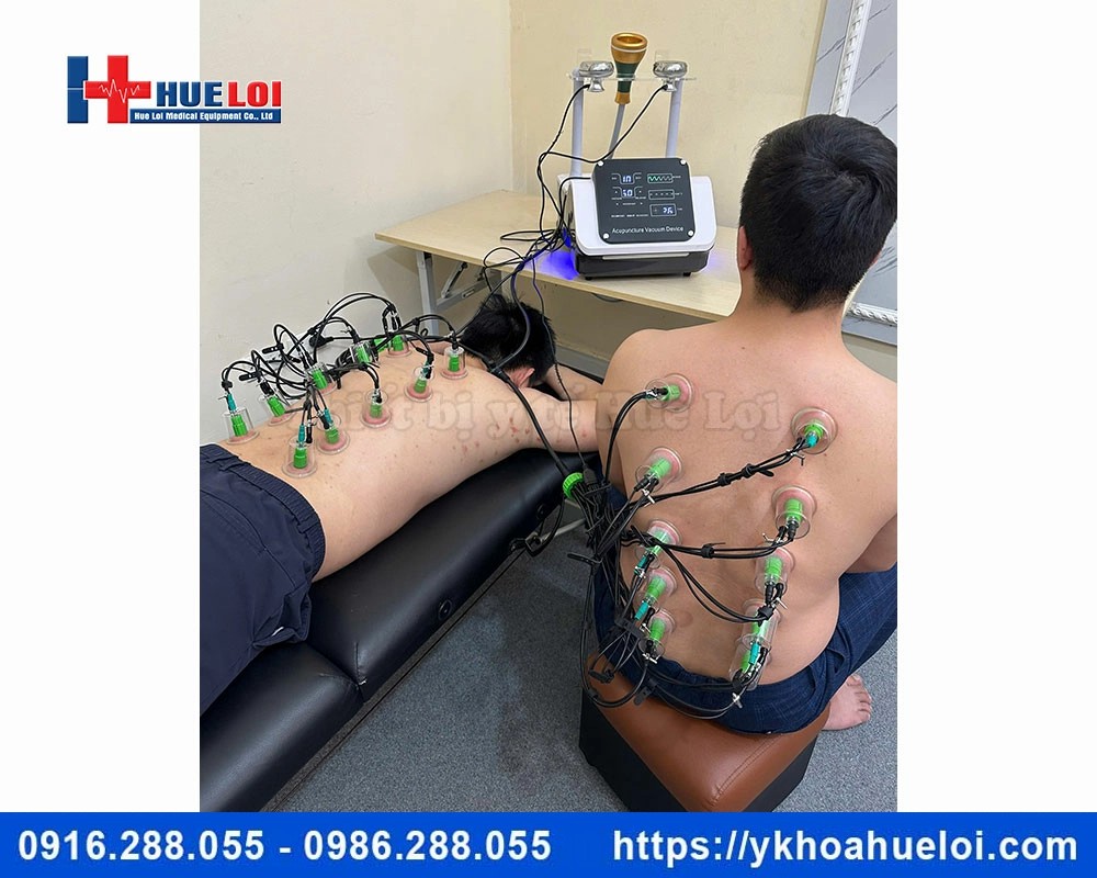 Máy điện châm ko kim kết hợp giác hút