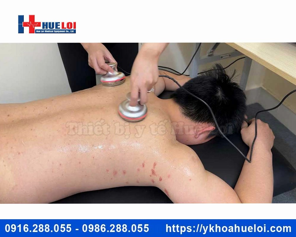 Máy điện châm ko kim kết hợp giác hút