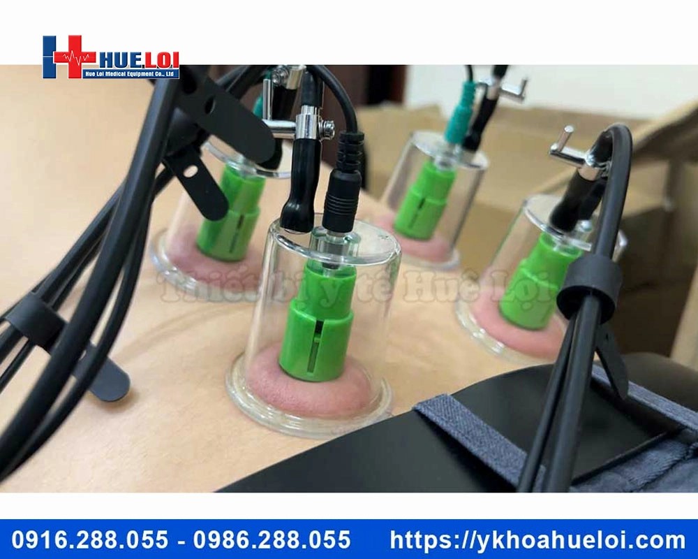 Máy điện châm ko kim kết hợp giác hút