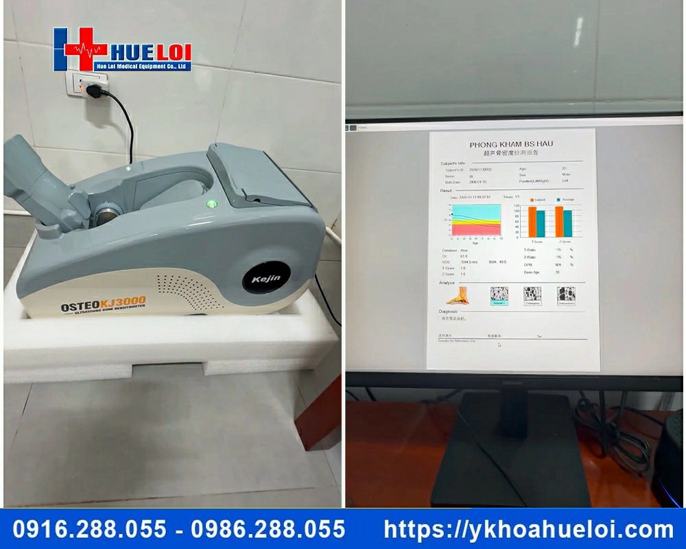 Máy đo loãng xương gót chân OSTEOKJ3000