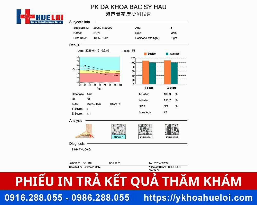 Máy đo loãng xương gót chân OSTEOKJ3000