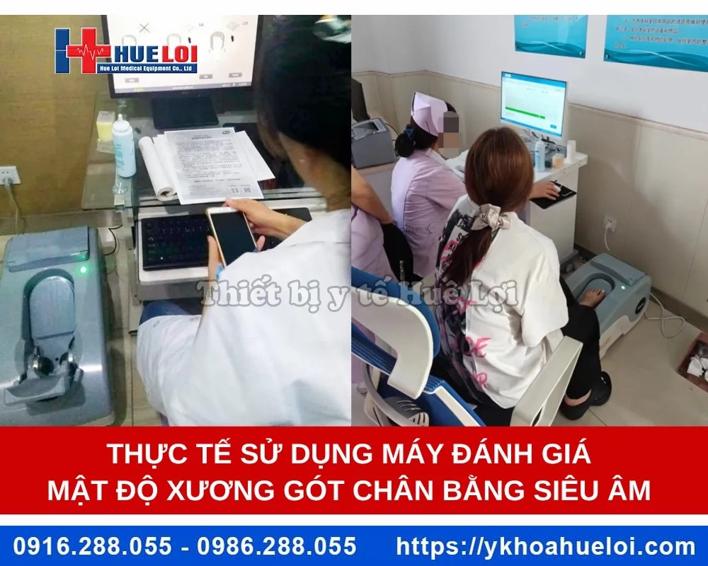 Máy đo loãng xương gót chân cao cấp OSTEOKJ3000M