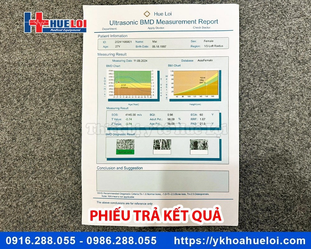 Máy đo mật độ xương bằng sóng siêu âm BMD-A1