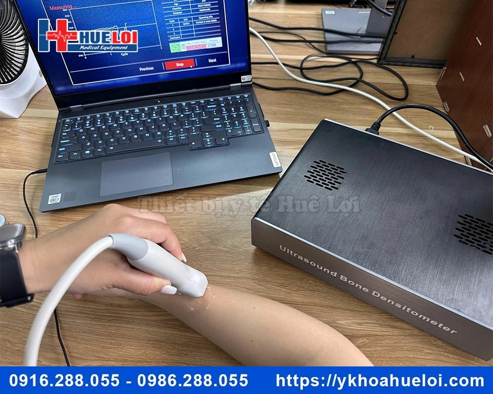 Máy đo mật độ xương bằng sóng siêu âm BMD-A1