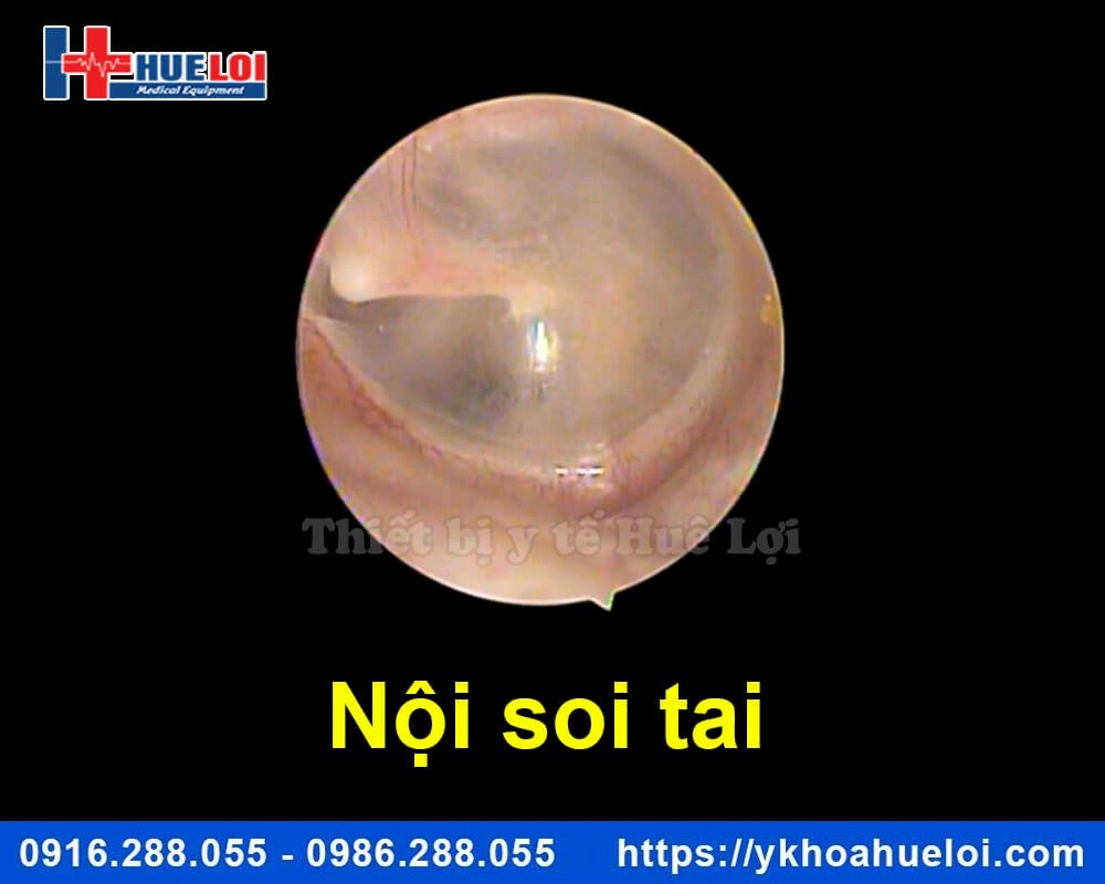 máy nội soi tai mũi họng mini