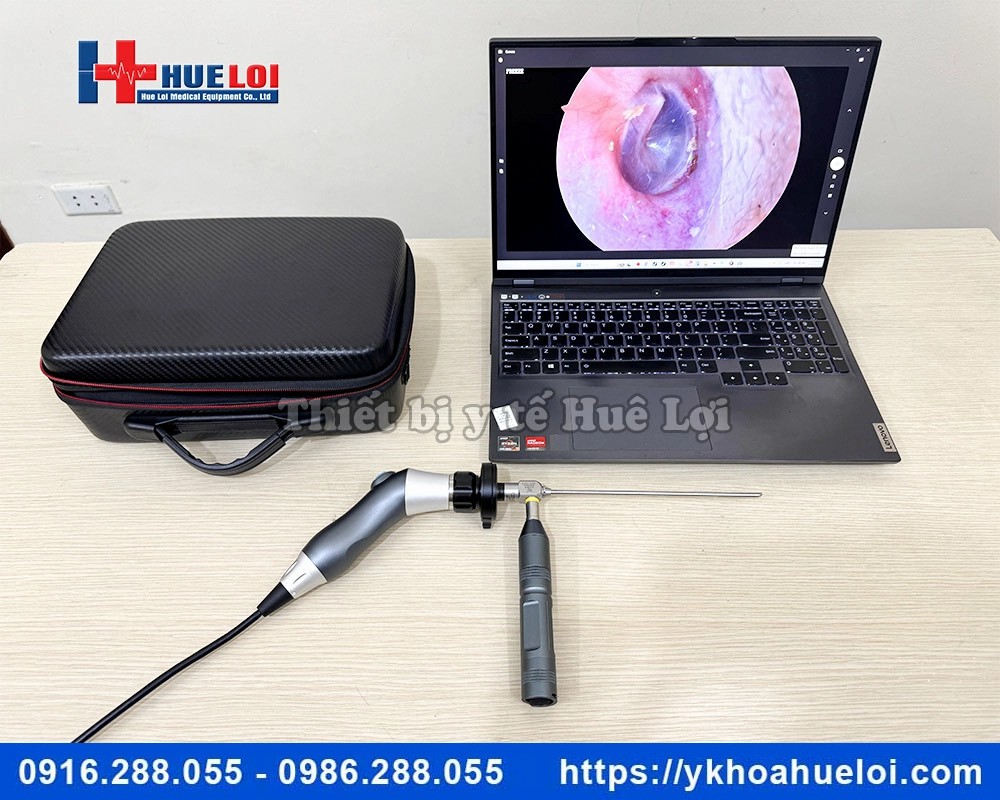 Máy nội soi tai mũi họng mini full HD