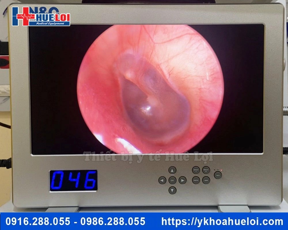 máy nội soi tai mũi họng full HD NCM-15