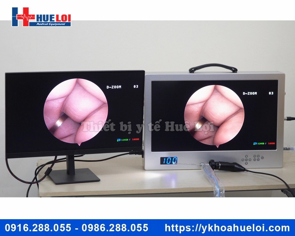 máy nội soi tai mũi họng full HD NCM-24