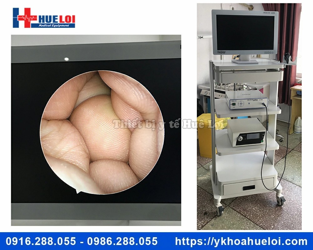 Máy nội soi tai mũi họng hình ảnh SD TJ-168A