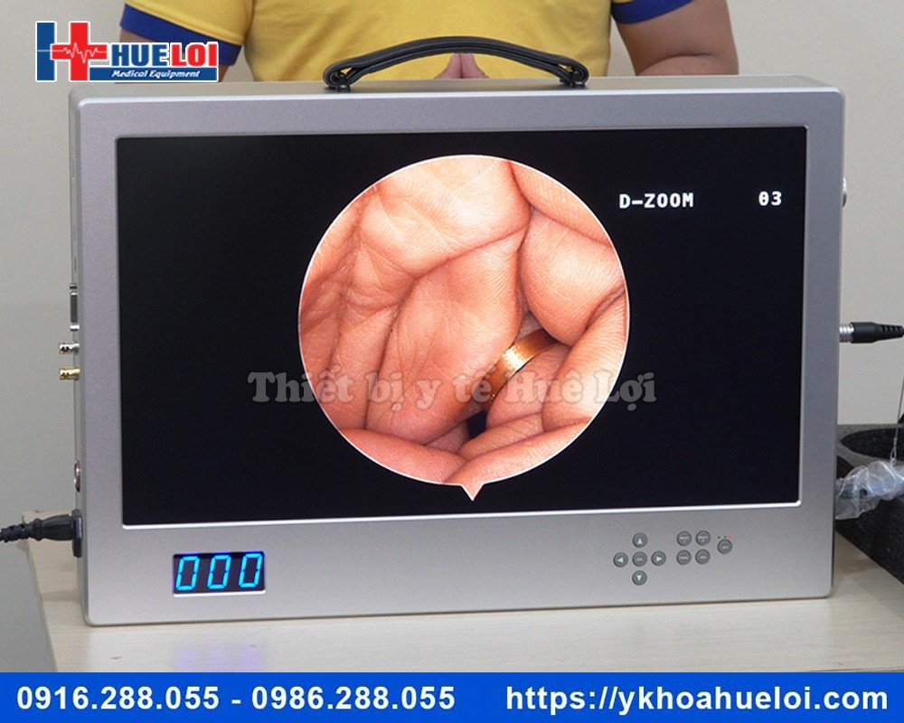 Máy nội soi tai mũi họng full HD NCM-24