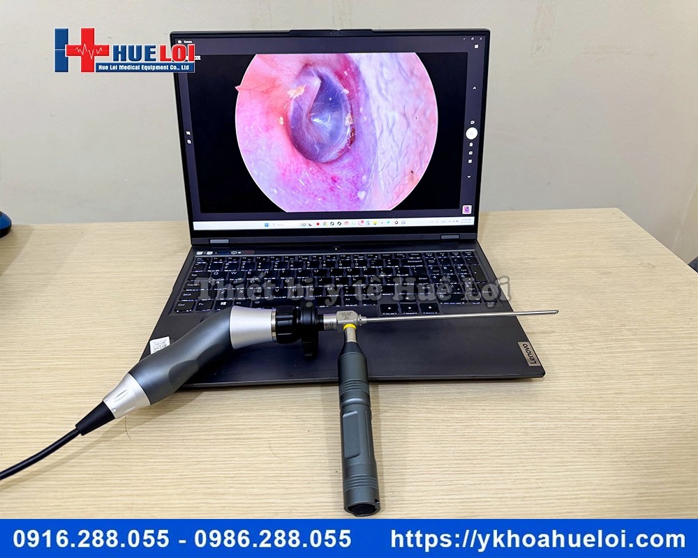 Máy nội soi tai mũi họng mini full HD
