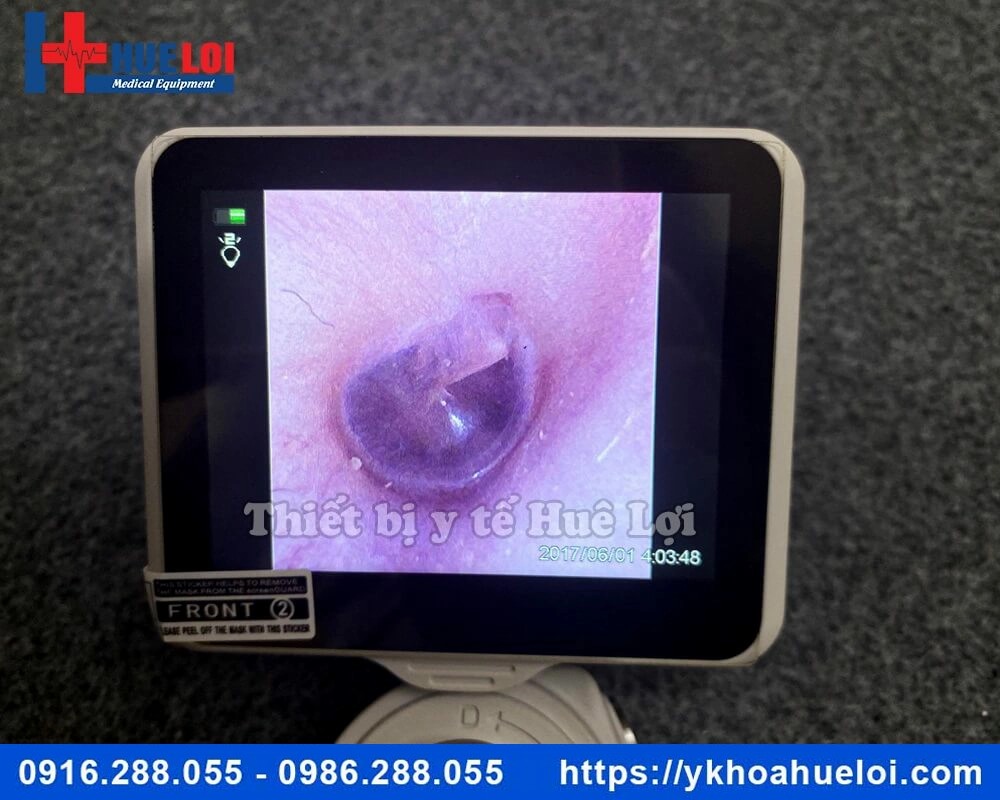 Máy nội soi tai mũi họng ống mềm giá rẻ