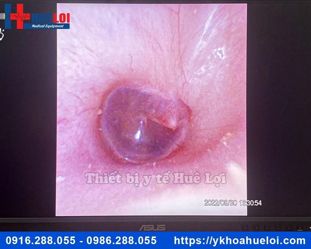 Máy nội soi tai mũi họng ống mềm giá rẻ