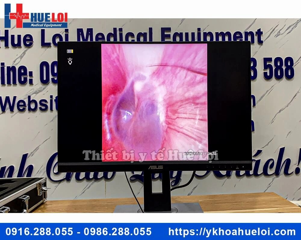 Máy nội soi tai mũi họng ống mềm giá rẻ