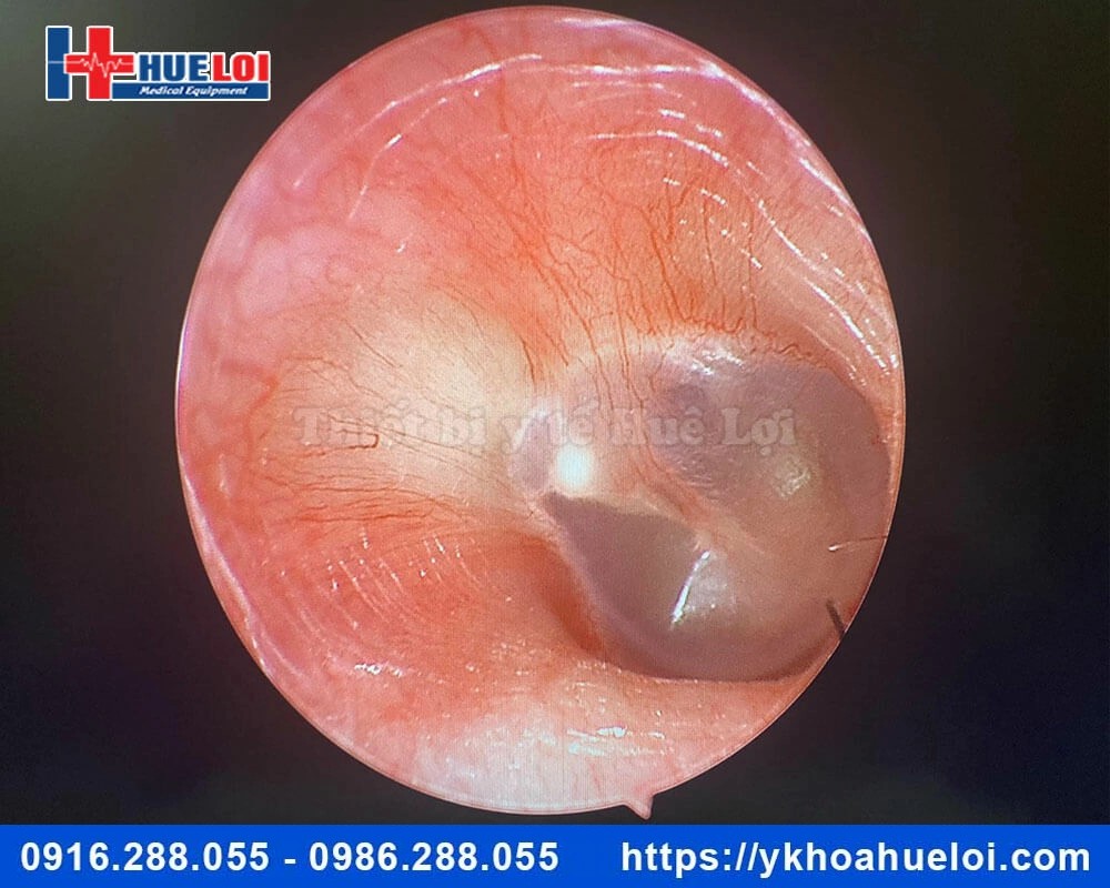 Máy nội soi Tai Mũi Họng Full HD 168B