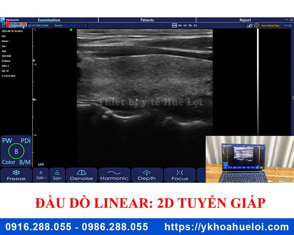 Máy siêu âm cầm tay 3 đầu dò C5 Plus