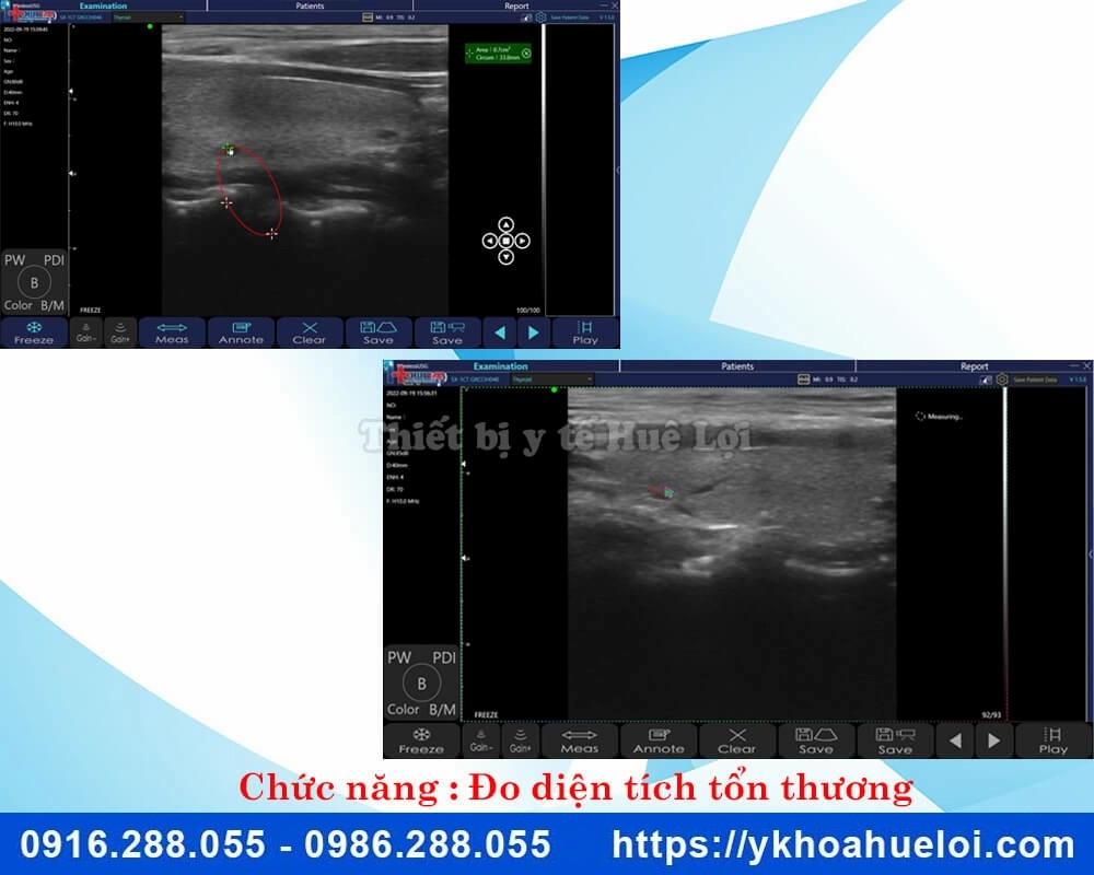 Máy siêu âm cầm tay 3 đầu dò C5 Plus