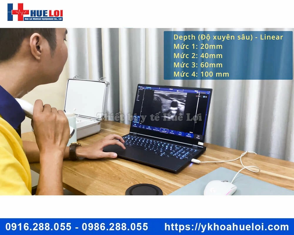 Máy siêu âm cầm tay 3 đầu dò C5 Plus