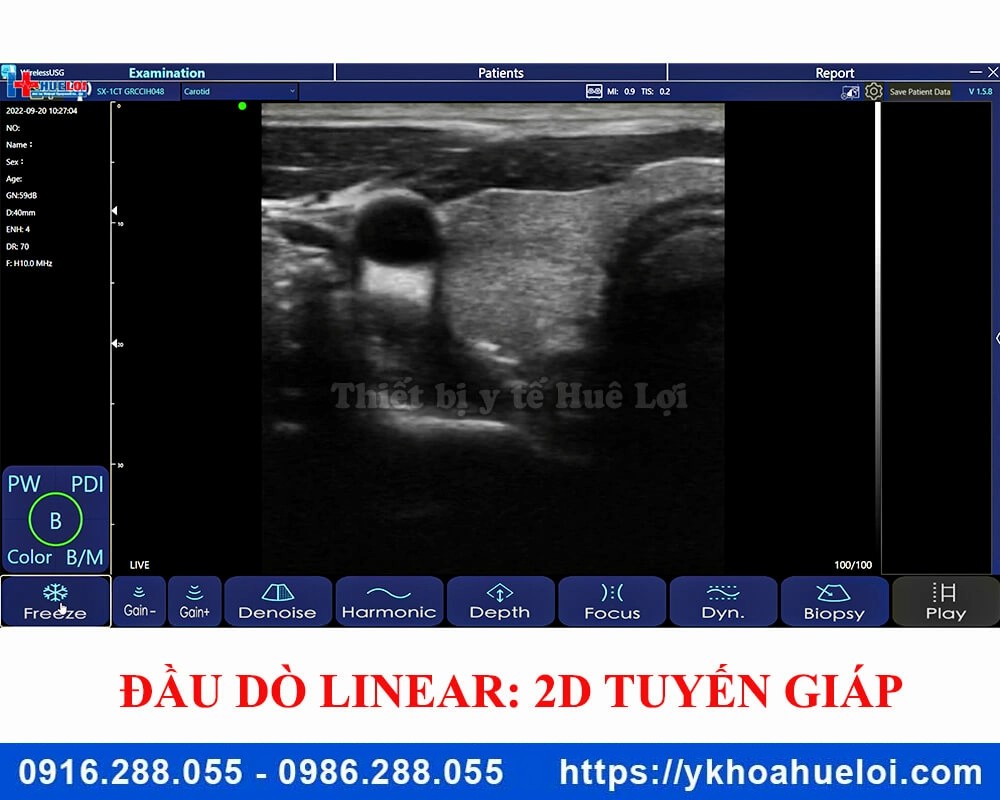 Máy siêu âm cầm tay 3 đầu dò C5 Plus