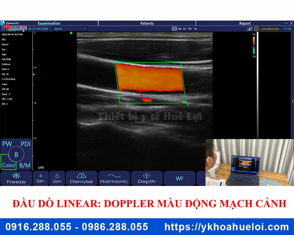 Máy siêu âm cầm tay 3 đầu dò C5 Plus