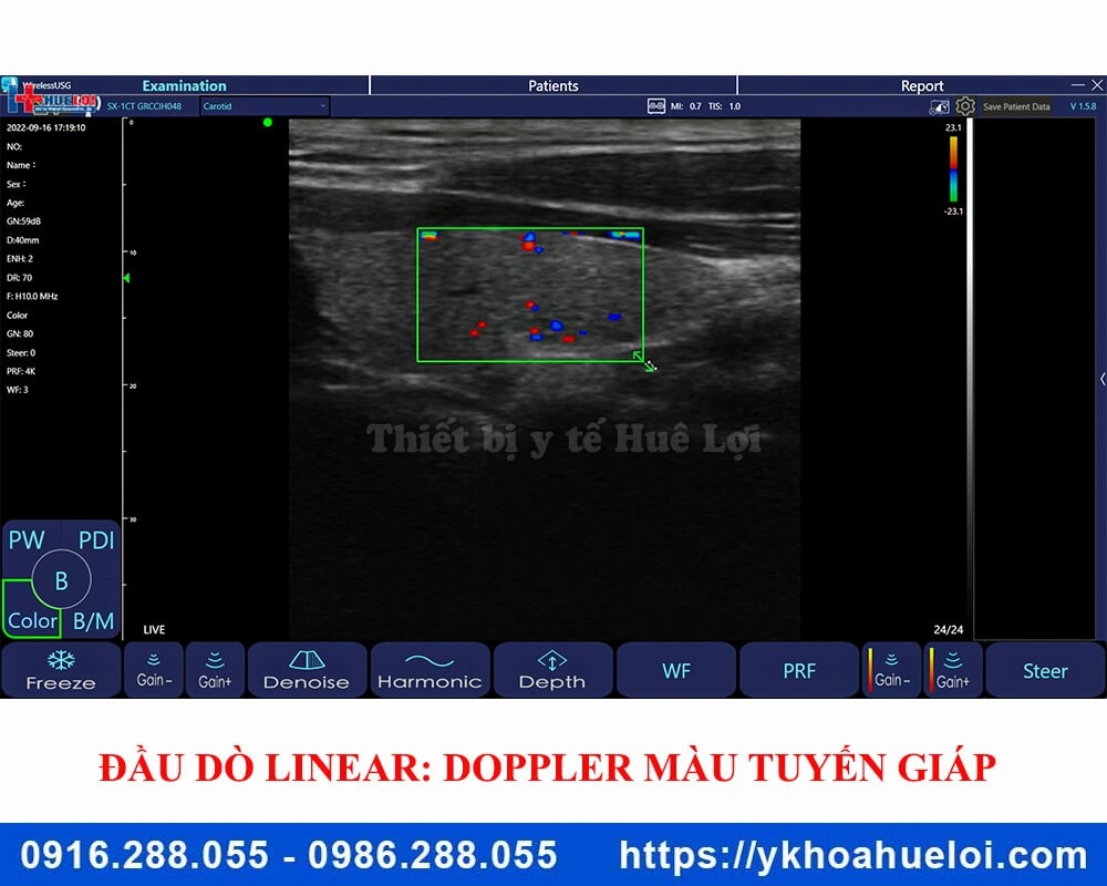 Máy siêu âm cầm tay 3 đầu dò C5 Plus