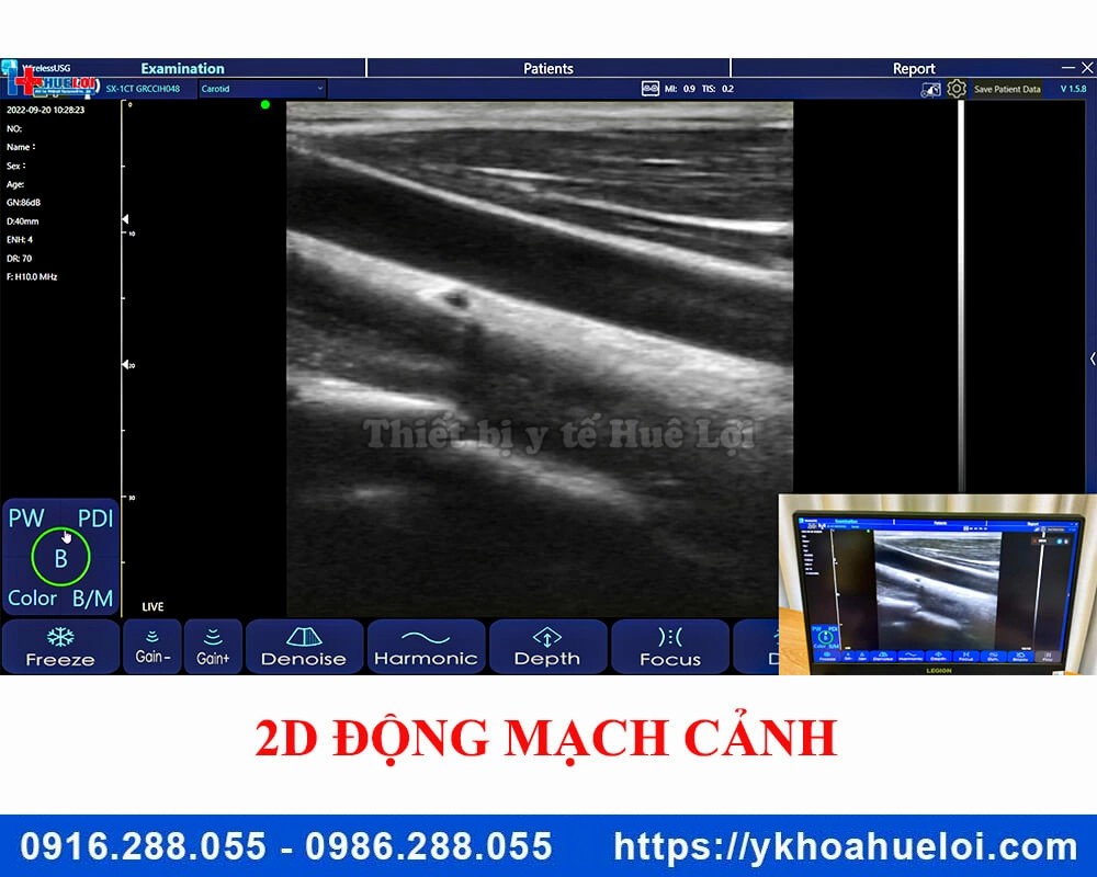 Máy siêu âm cầm tay 3 đầu dò C5 Plus