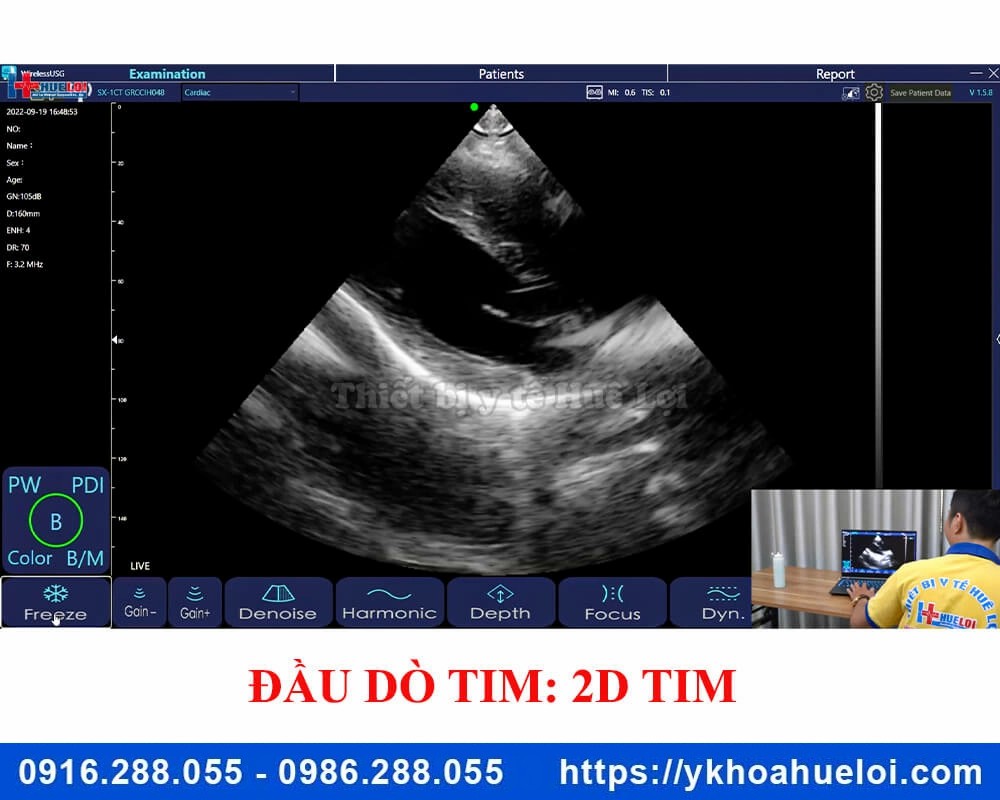 Máy siêu âm cầm tay 3 đầu dò C5 Plus