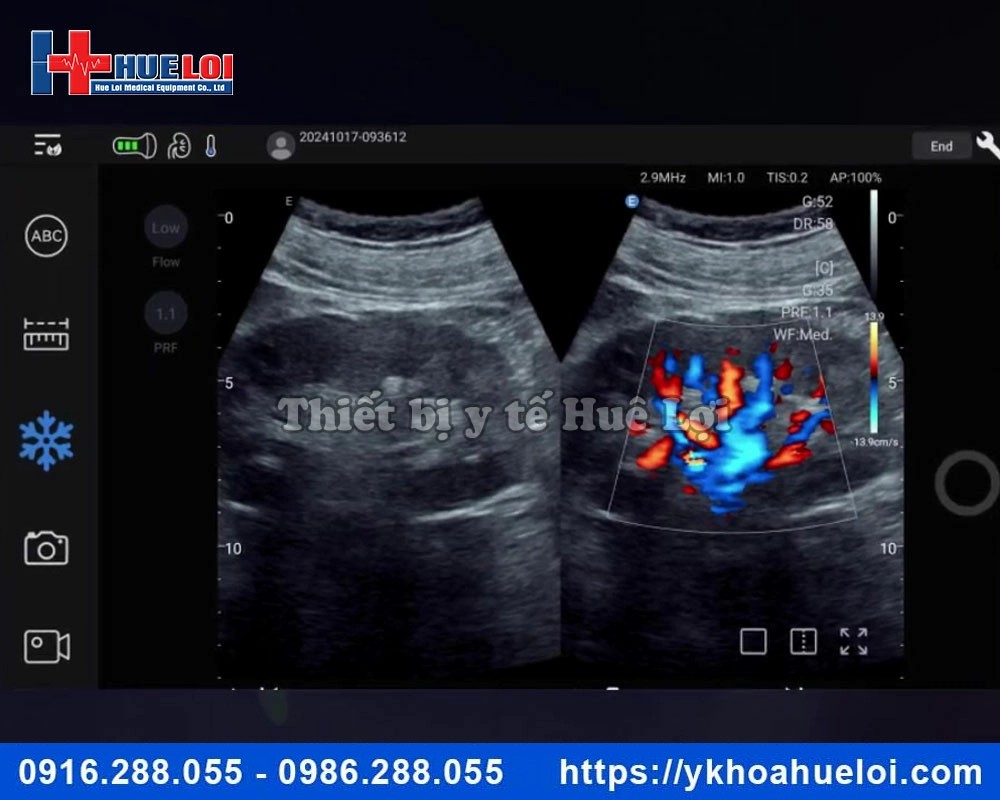 Máy siêu âm hình ảnh cầm tay EDAN NANO C5 EXP