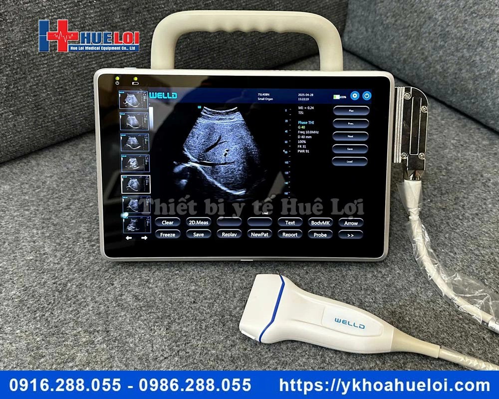 Máy siêu âm xách tay cảm ứng Well.D - P10