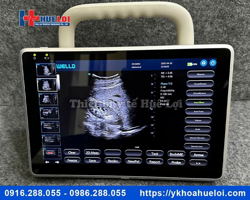 Máy siêu âm xách tay cảm ứng Well.D - P10