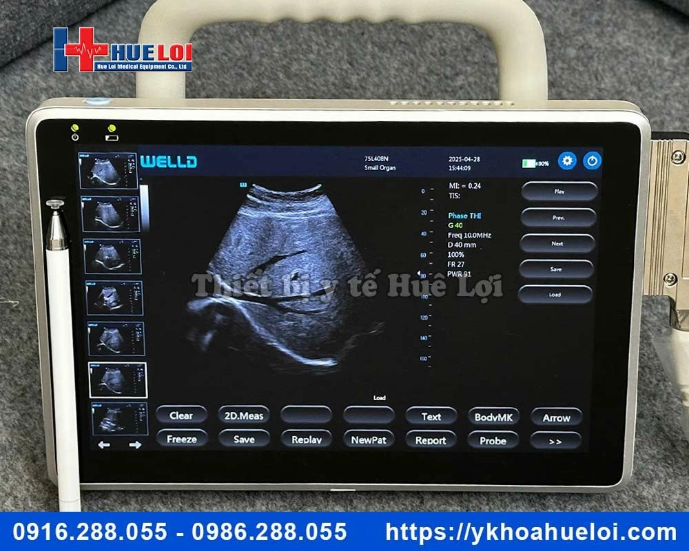 Máy siêu âm xách tay cảm ứng Well.D - P10