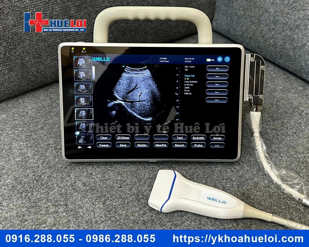 Máy siêu âm xách tay cảm ứng Doppler màu P10