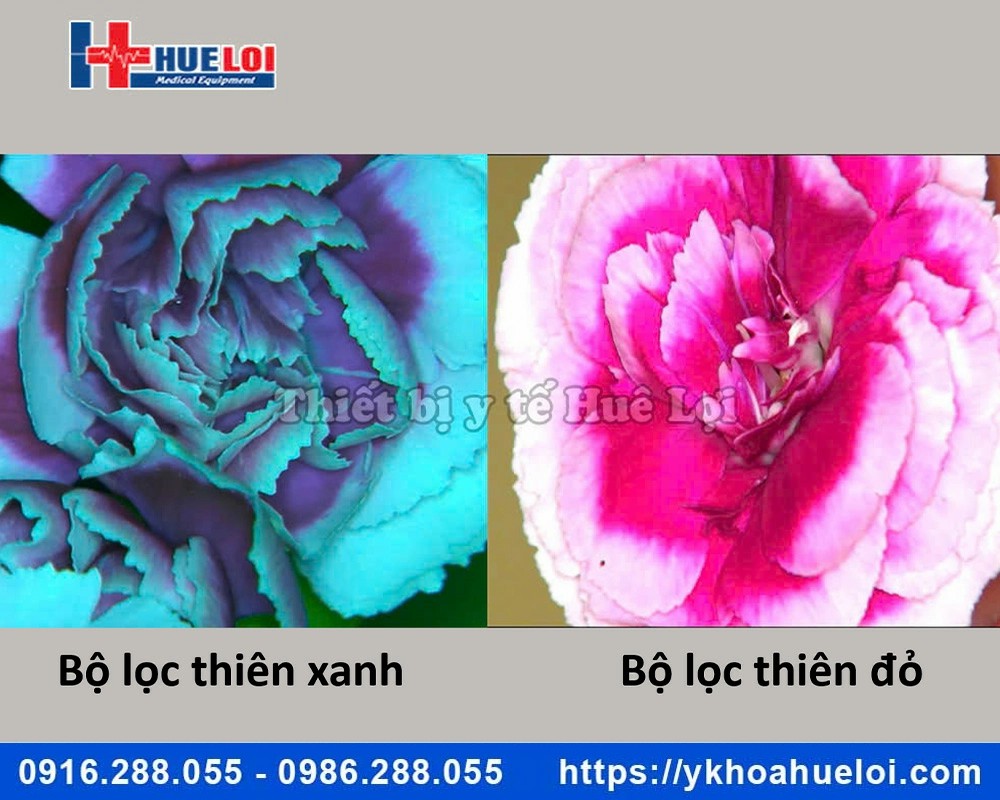 Máy soi cổ tử cung ECOCON Full HD