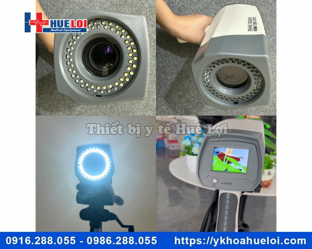 Máy soi cổ tử cung ECOCON Full HD