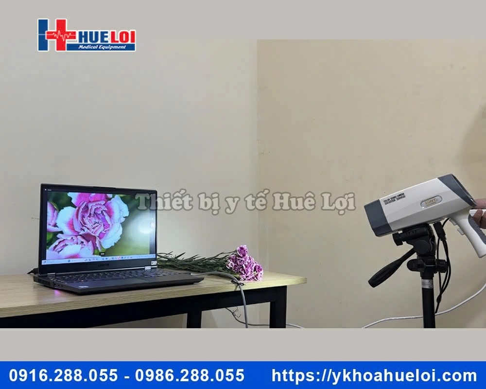 Máy soi cổ tử cung ECOCON Full HD