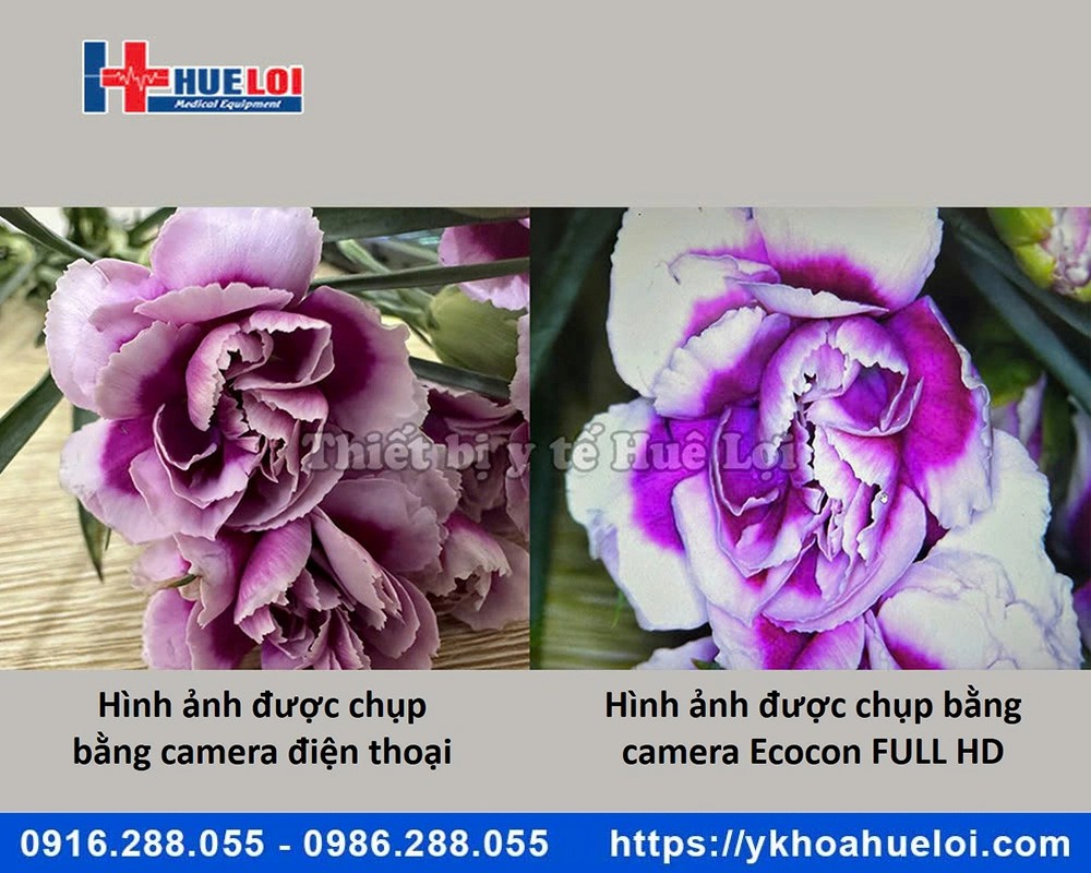 Máy soi cổ tử cung ECOCON Full HD