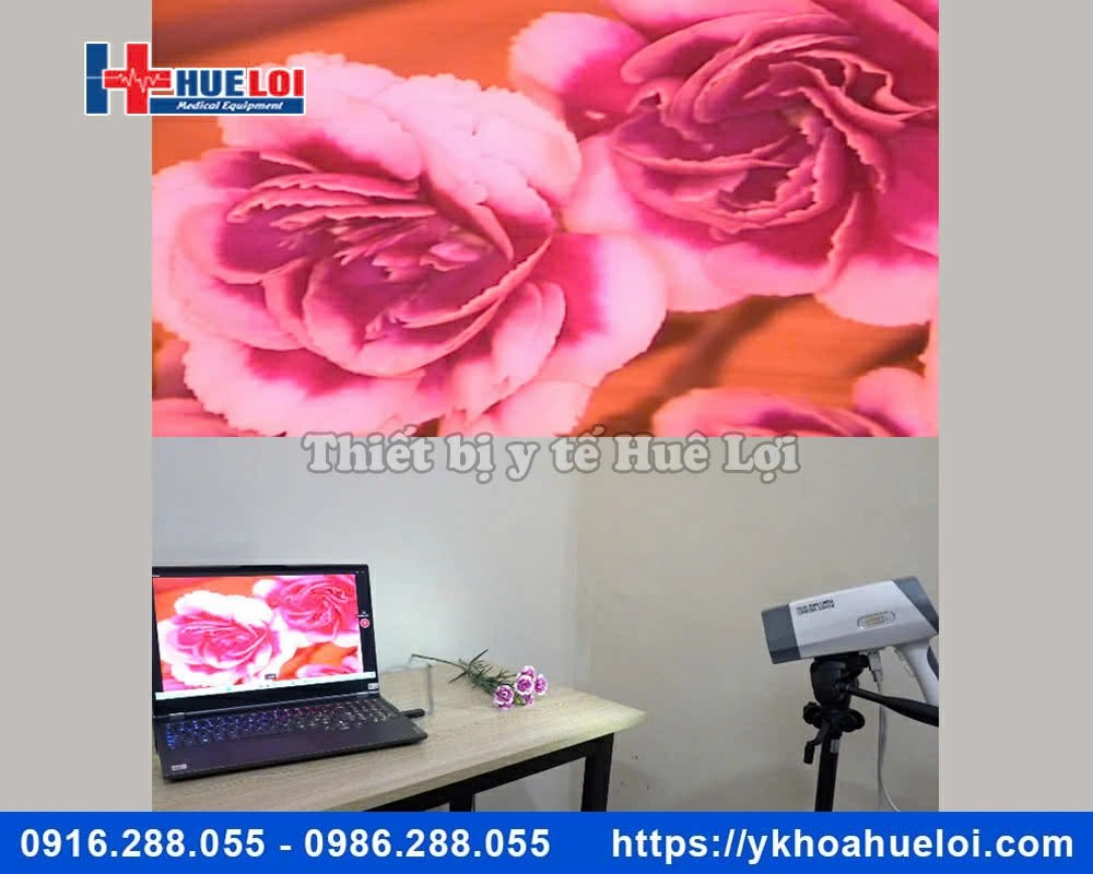 Máy soi cổ tử cung hình ảnh SD